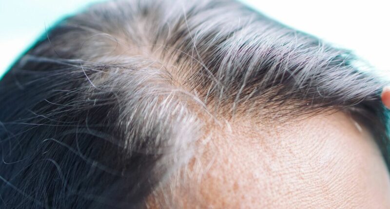 Thinning hair could be warning sign your body needs one thing