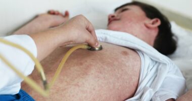 Thousands at risk of deadly complications after measles exposure