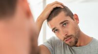Treatment to reverse hair loss that's 50 times cheaper than transplant