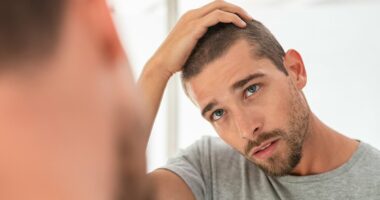 Treatment to reverse hair loss that's 50 times cheaper than transplant