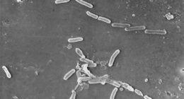 Electron microscope image shows rod-shaped Pseudomonas aeruginosa bacteria