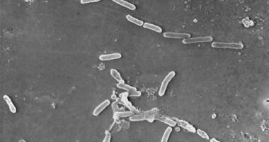 Electron microscope image shows rod-shaped Pseudomonas aeruginosa bacteria