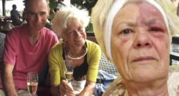 ‘A red dot was the first sign of illness that caused me pain for 13 years’