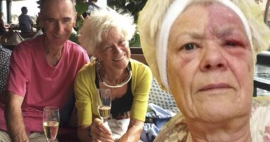 ‘A red dot was the first sign of illness that caused me pain for 13 years’