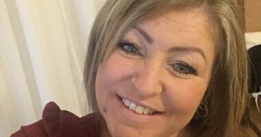 A freak accident with a common household appliance left me disfigured