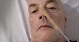 Aussie tells how an over the counter drug left him clinically dead