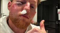 Stokes said he is ‘lucky’ to be alive after a ball broke his cheekbone during a net session at Durham in February