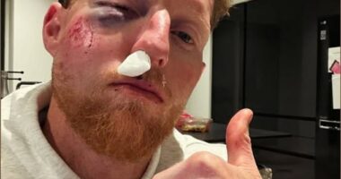 Stokes said he is ‘lucky’ to be alive after a ball broke his cheekbone during a net session at Durham in February