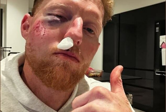 Stokes said he is ‘lucky’ to be alive after a ball broke his cheekbone during a net session at Durham in February