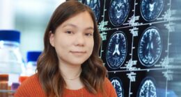 Breakthrough dementia drugs — what went wrong and what happens next?