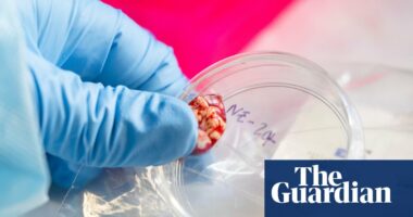 CDC temporarily halts testing for several infectious diseases amid staffing shortages