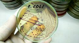 Chinese researcher on US visa pleads guilty to smuggling E. coli into the country