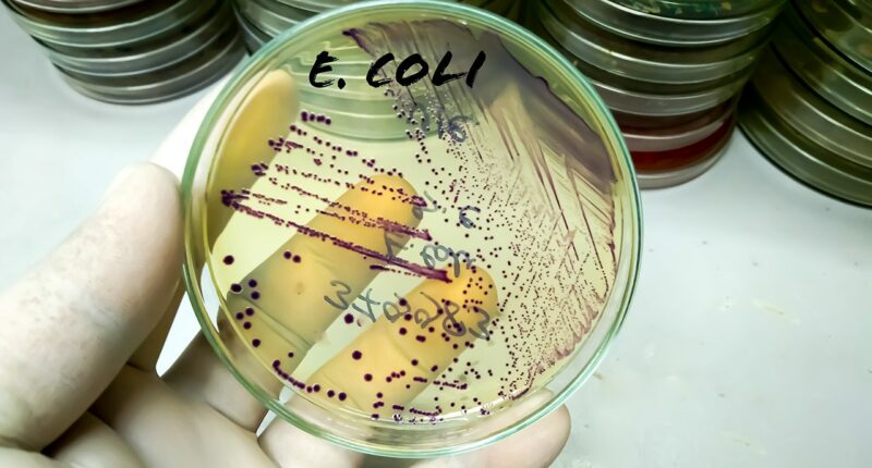Chinese researcher on US visa pleads guilty to smuggling E. coli into the country