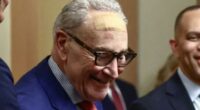 Chuck Schumer wore giant bandage on forehead for King Charles III speech why
