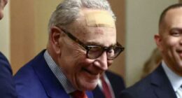 Chuck Schumer wore giant bandage on forehead for King Charles III speech why