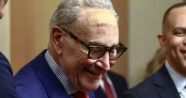 Chuck Schumer wore giant bandage on forehead for King Charles III speech why