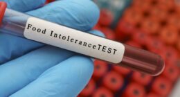 DWP benefits claims for food issues surge by 500%