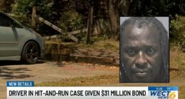 Driver severed leg of boy sitting on bike in driveway: Cops