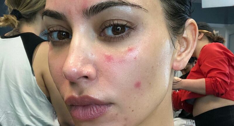 How to cure psoriasis WITHOUT drugs: ETHAN ENNELS reveals the answers