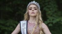 I was a pageant queen who proudly flaunted my beauty to the world... then severe acne ruined my life