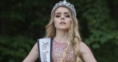 I was a pageant queen who proudly flaunted my beauty to the world... then severe acne ruined my life