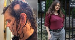 I was losing hair so fast a bald spot the size of an orange appeared. I owe my life to a $1 at-home treatment that REVERSED the damage in a month. Every woman needs to know this