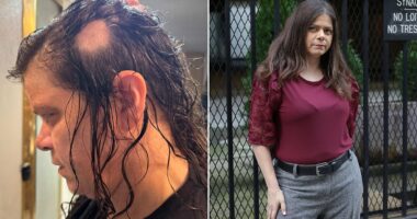 I was losing hair so fast a bald spot the size of an orange appeared. I owe my life to a $1 at-home treatment that REVERSED the damage in a month. Every woman needs to know this