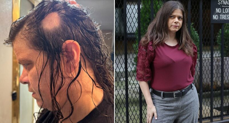 I was losing hair so fast a bald spot the size of an orange appeared. I owe my life to a $1 at-home treatment that REVERSED the damage in a month. Every woman needs to know this