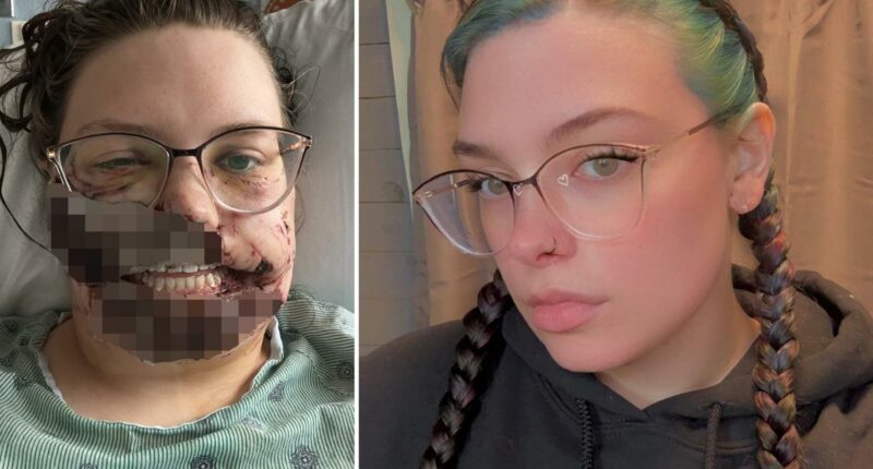 Illinois mom gets face ripped apart by rescue dog after suffering seizure