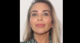 Manhunt Underway for Florida Woman Accused of Stealing HOA Funds for Plastic Surgery, Vacations