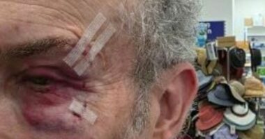 Melbourne pharmacy owner brutally assaulted in his own store