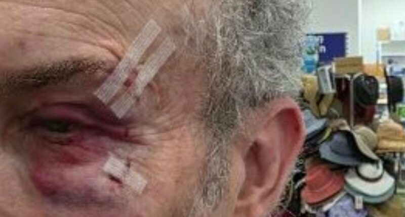 Melbourne pharmacy owner brutally assaulted in his own store