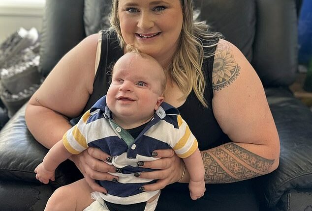 Maddicyn Brokenshire was overcome with worry after finding out her son, Ollyver, was battling Amniotic Band Syndrome (ABS)