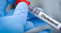 NHS explains 'best way' to lower high cholesteral and all those most at risk