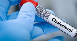 NHS explains 'best way' to lower high cholesteral and all those most at risk
