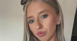 Nail technician left with horrific injuries in unprovoked dog attack