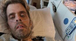 Perez Hilton undergoes emergency surgery after he nearly died