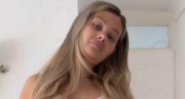 Shaughna Phillips proudly shows off her cellulite and lipoedema flare up as she reveals her impressive weight loss in before and after photos