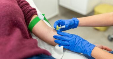 Simple blood test could spot dementia changes in your gut