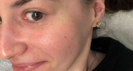 The beauty secret behind celebrities' glowing skin on the red carpet