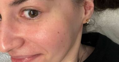 The beauty secret behind celebrities' glowing skin on the red carpet