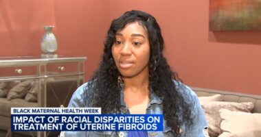 Woman has 27-pound fibroid removed during pregnancy at Loretto Hospital on Chicago's West Side