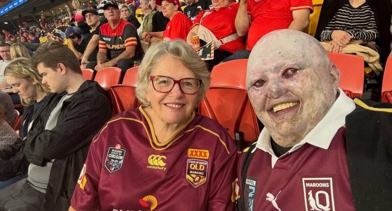 Aussie with an agonising skin condition goes to the footy with his mum - and what happened next will make your blood boil