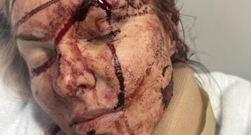 Charlie Teo's girlfriend speaks out after suffering horror injuries