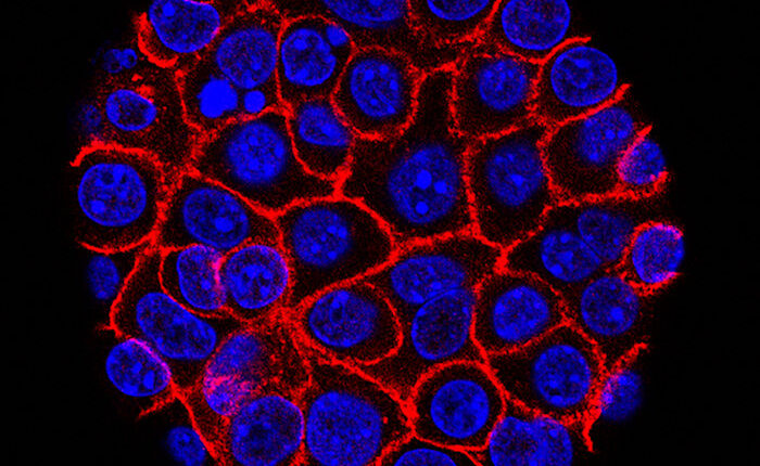 Experimental pill promises new hope for deadly pancreatic cancer