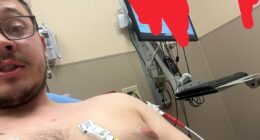 Kyle Rittenhouse hospitalized after nasty venomous spider bite