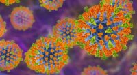 Victorian disease rips through the UK – 542 new cases reported