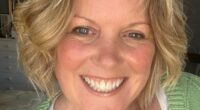 Woman, 54, shows off incredible results after removing 'snake' vein