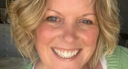 Woman, 54, shows off incredible results after removing 'snake' vein