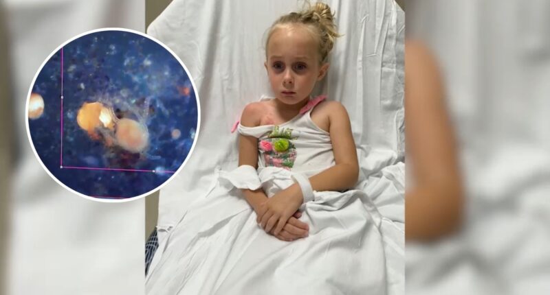 6-year-old stung by invasive clinging jellyfish in New Jersey's Metedeconk River